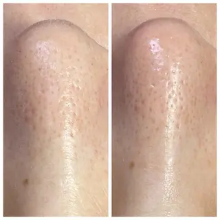 産毛専門店 Bittoのエステ・リラクイメージ