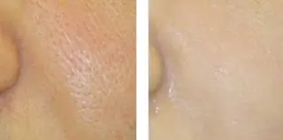 salon merci和泉のエステ・リラクイメージ