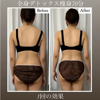 Beautysalon YURA所属・リンパ＆小顔美肌 YURA/Ayakaのエステ・リラクイメージ