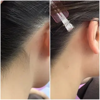 A"-HILU(アーヒル)所属・A"-HILU （アーヒル)のエステ・リラクイメージ