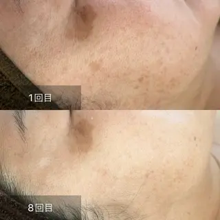 Beauty Salon Ciel　Chiba所属・BeautySalo nCielChibaのエステ・リラクイメージ