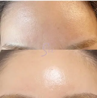 スキンケアサロン　デディア所属・米谷🎀 デディア恵比寿🪞✨のエステ・リラクイメージ