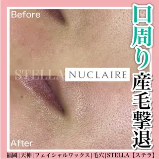 ドライヘッドスパ＆ リンパ専門店　ステラのエステ・リラクイメージ