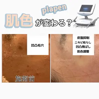 Lumiere despoir所属・Lumiere despoirのエステ・リラクイメージ