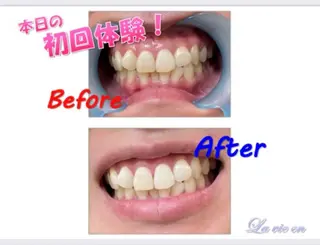 セルフホワイトニングサロン　ラヴィアン所属・ホワイトニングサロン La vie enのその他イメージ