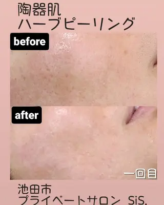 BEAUTYSARON　SiS.所属・高橋 沙奈江のエステ・リラクイメージ