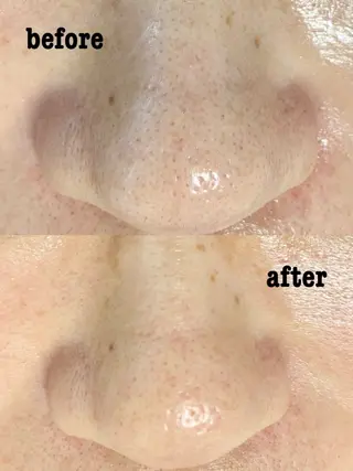 SALON MAREのネイルデザイン