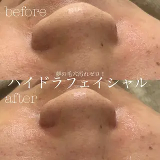 フェイシャルサロン CHIARA 荒田のエステ・リラクイメージ