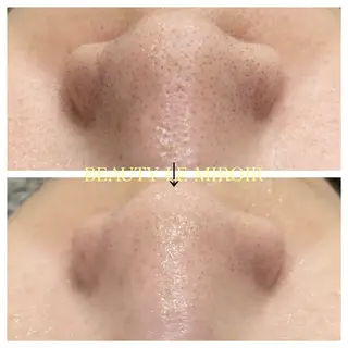 ビューティー ミロワールのエステ・リラクイメージ