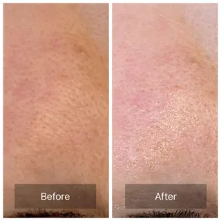 facial aesthetic salon SENTEUR所属・美肌改善/毛穴/シミ サントゥールのエステ・リラクイメージ