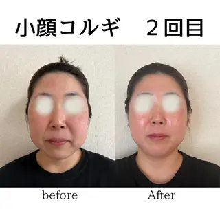 小顔コルギ&肌質改善 の専門店LIBREのエステ・リラクイメージ