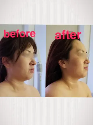 美と癒しのお店OTOHA 2nd所属・OTOHA 2nd ：yanoのエステ・リラクイメージ