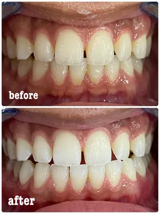 ホワイトニングサロン ラウレアのその他イメージ