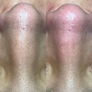 セルフエステエンリケ明石大久保店所属・夕希リンパ&痩身& 脱毛&毛穴ケアのエステ・リラクイメージ