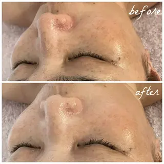 メンズ メナード岐阜茜部 杉浦のエステ・リラクイメージ