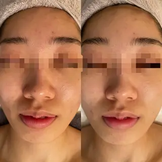 田中For..天王寺 肌質改善/よもぎ蒸しのエステ・リラクイメージ