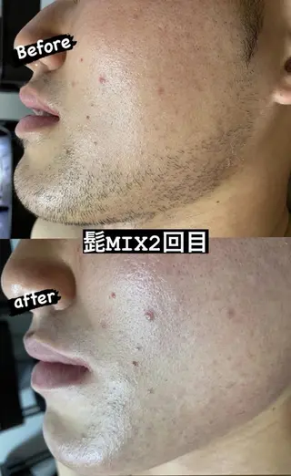 キッズ メンズ Epina 千葉店 【エピナ】のエステ・リラクイメージ