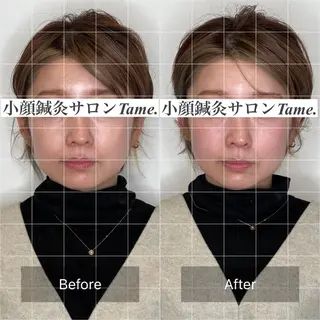 Lenne所属・佐藤 彰太のエステ・リラクイメージ