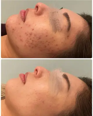 ハーブピーリング専門 BIOPLUS＋川崎のエステ・リラクイメージ