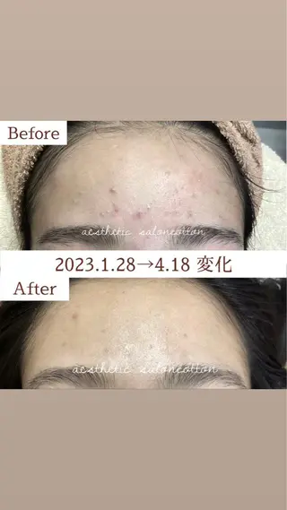 都度払い 肌質改善専門サロンのエステ・リラクイメージ