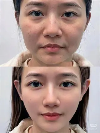 ネイル aliaハイフ&水光ジェットサロン所属・aliaハーブ水光店 エステティシャン募集のエステ・リラクイメージ