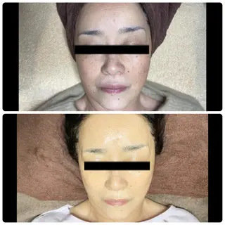 代表 MOMOのエステ・リラクイメージ