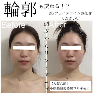 リフトアップ小顔 専門のエステ・リラクイメージ