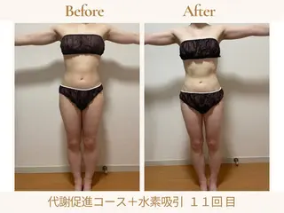 あみ|痩身の最先端 よもぎ蒸しサロン大塚のエステ・リラクイメージ