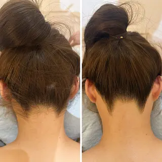 うなじ脱毛/美肌脱毛 LABELのエステ・リラクイメージ