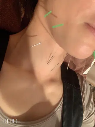 美容鍼灸イロドリ  のエステ・リラクイメージ