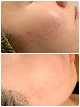 Dione八王子店所属・LUKE （ルーク）のエステ・リラクイメージ