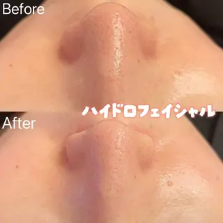 アイラッシュ&エステサロンLinda西宮所属・小顔&毛穴・肌質改善 LINDA西宮 AIのエステ・リラクイメージ