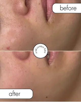 OAK×NACHUL 成城学園前のエステ・リラクイメージ