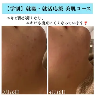 Bellesthe （ベルエステ）のエステ・リラクイメージ