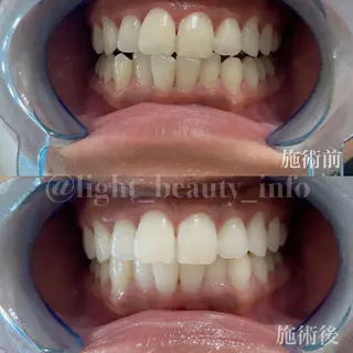 ライトビューティー 銀座店のエステ・リラクイメージ