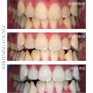 ホワイトニングラウンジ横須賀所属・ホワイトニング Lounge横須賀のその他イメージ