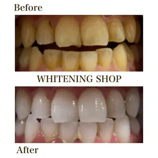 ホワイトニングショップ静岡葵区店所属・ホワイトニング ショップ葵区静岡駅店のその他イメージ