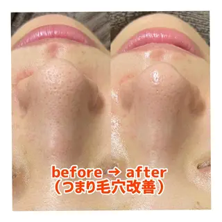 〜小顔・痩身・リラクゼーション〜　　Y&o Esthetic  Salon所属・HANA MIKIの眉毛・アイブロウイメージ