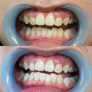 カラー メンズ キッズ あらかき 接骨院のエステ・リラクイメージ