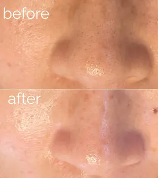 毛穴ケア専門サロン m&uのエステ・リラクイメージ