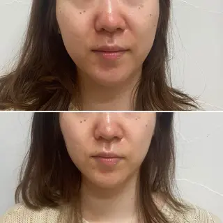 amy amie salon所属・amy amie 上村のマツエク・マツパデザイン