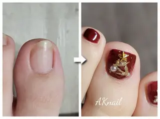 ネイル ネイル&巻き爪サロン 　AKnailのネイルデザイン