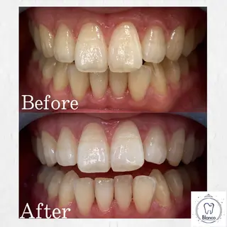 Blanco川口駅前店所属・Blanco 川口駅前店のその他イメージ