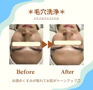 White labo 今村のエステ・リラクイメージ