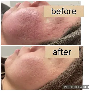 total beauty  salon RIRE所属・古川 弥生のエステ・リラクイメージ