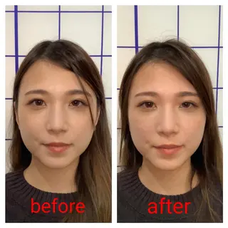 お顔のむくみたるみ 専門☆美容鍼小顔矯正のエステ・リラクイメージ