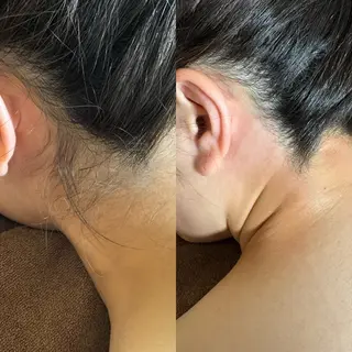 六本木脱毛andS 店長Sachiのエステ・リラクイメージ