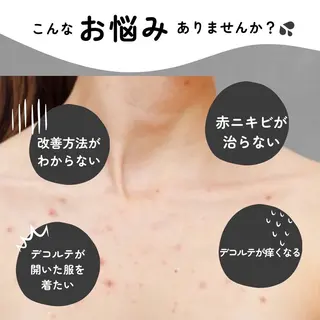 Meupニキビ専門店 背中/ハーブ/肌管理のその他イメージ