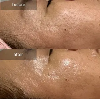 ALIA Scintiller  アリアサンティエ所属・齋藤 祐里耶のエステ・リラクイメージ