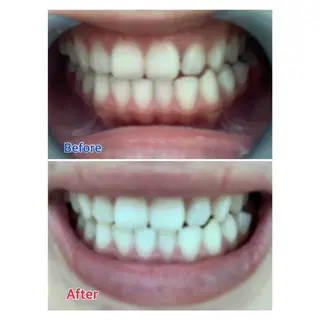 MBEAUTYSALON 千葉店・京成大久保所属・Melty 輝のその他イメージ